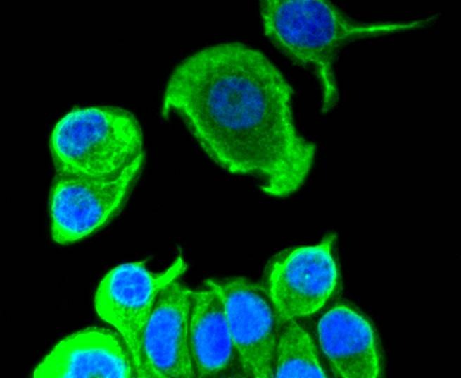 Anti-KRT8/18 Antibody (6E645)