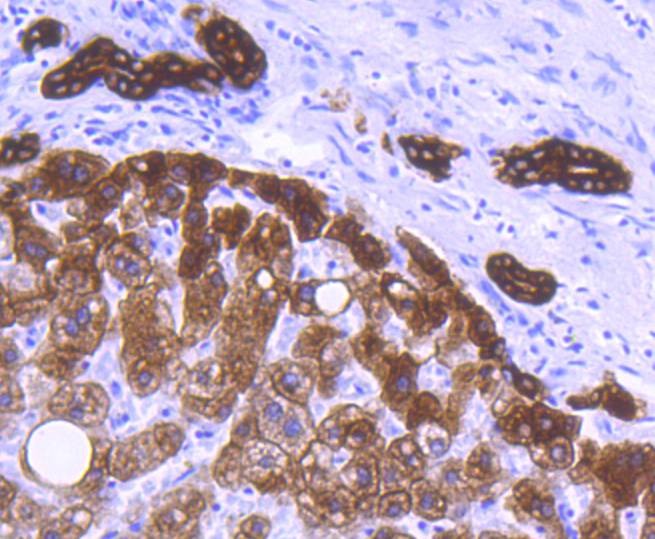 Anti-KRT8/18 Antibody (6E645)