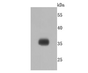 Anti-delta Sarcoglycan Antibody (5T99)