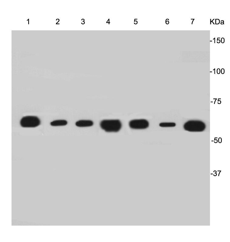 Anti-KRT7 Antibody (8D469)