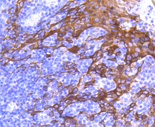 Anti-KRT6A Antibody (4G523)