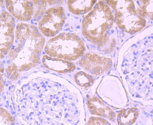 Anti-DDX6 Antibody (4T946)