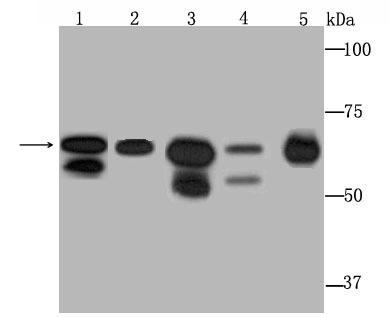 Anti-DDX5 Antibody (7B467)