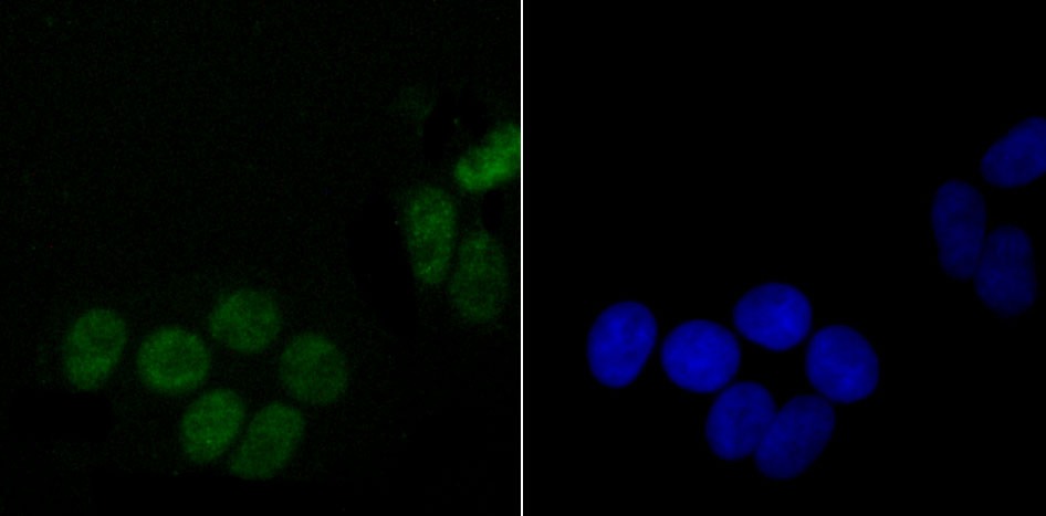 Anti-DDX5 Antibody (7B467)