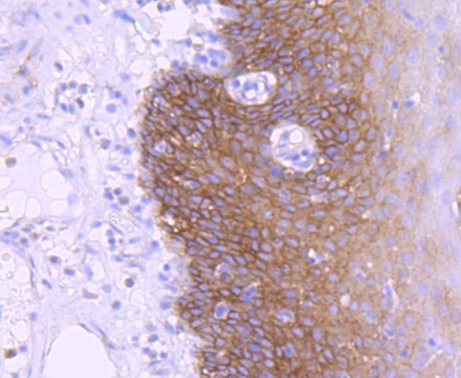 Anti-EGFR Antibody (9H356)