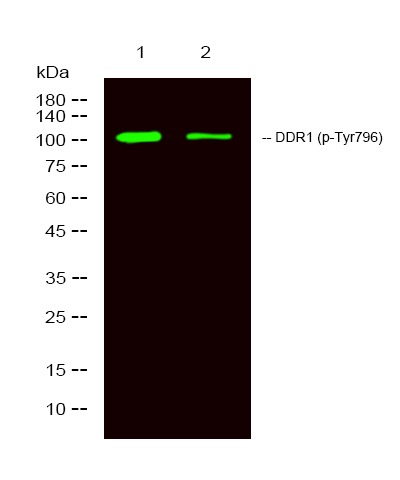 Anti-Phospho-DDR1 (Tyr796) Polyclonal Antibody