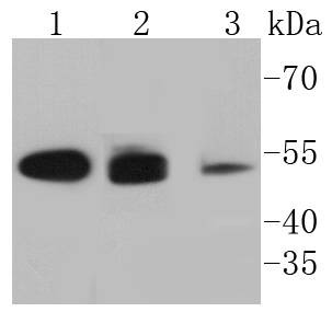 Anti-KRT8/18 Antibody (6E645)