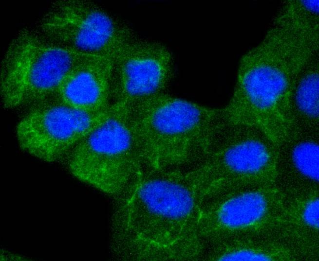 Anti-KRT8/18 Antibody (6E645)