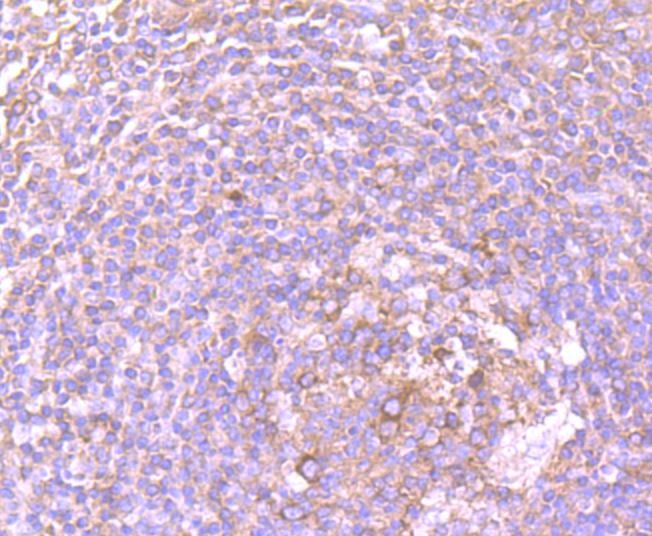 Anti-DDX6 Antibody (4T946)