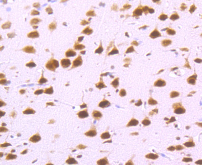 Anti-DDX5 Antibody (7B467)