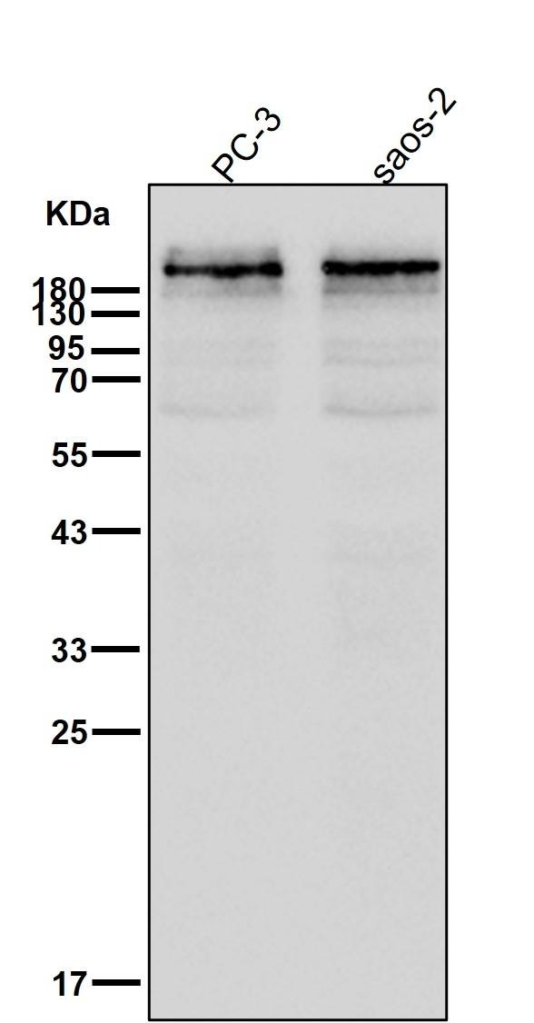 Anti-Dysferlin Antibody (4C391)