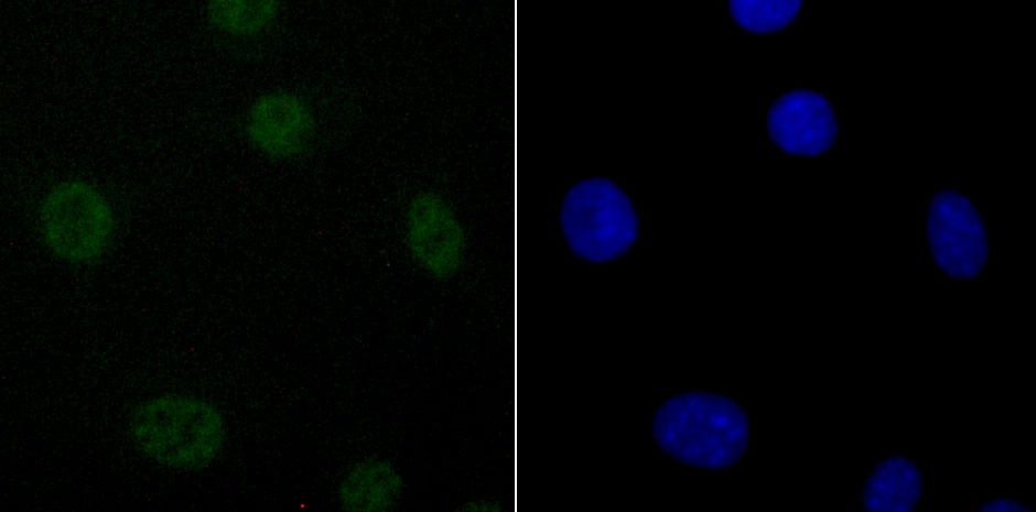 Anti-DDX5 Antibody (7B467)