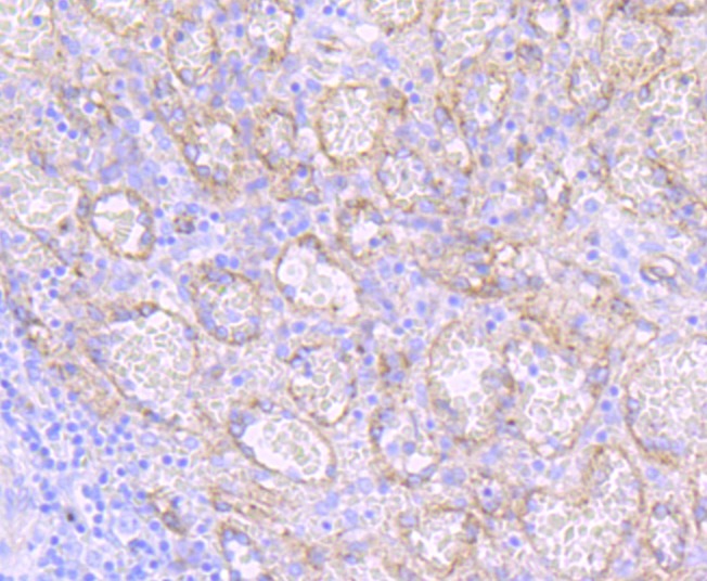 Anti-Dysferlin Antibody (4C391)