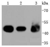 Anti-KRT18 Antibody (5J111)