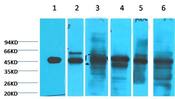Anti-KRT18 Antibody (1E909)