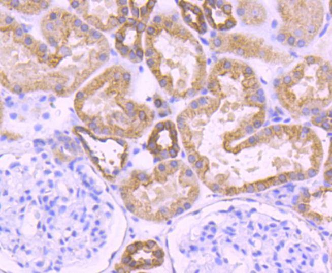 Anti-KRT18 Antibody (5J111)