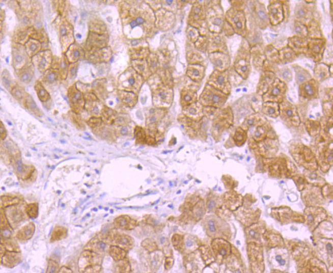 Anti-KRT18 Antibody (5J111)