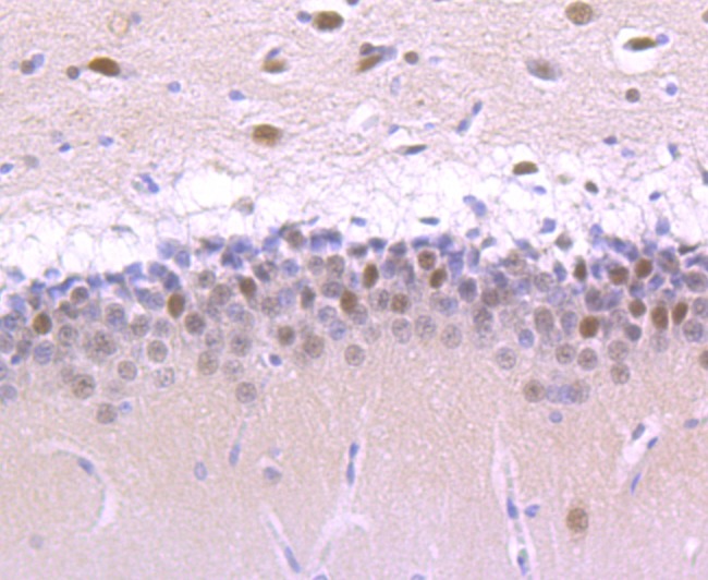 Anti-Cullin 1 Antibody (2P159)