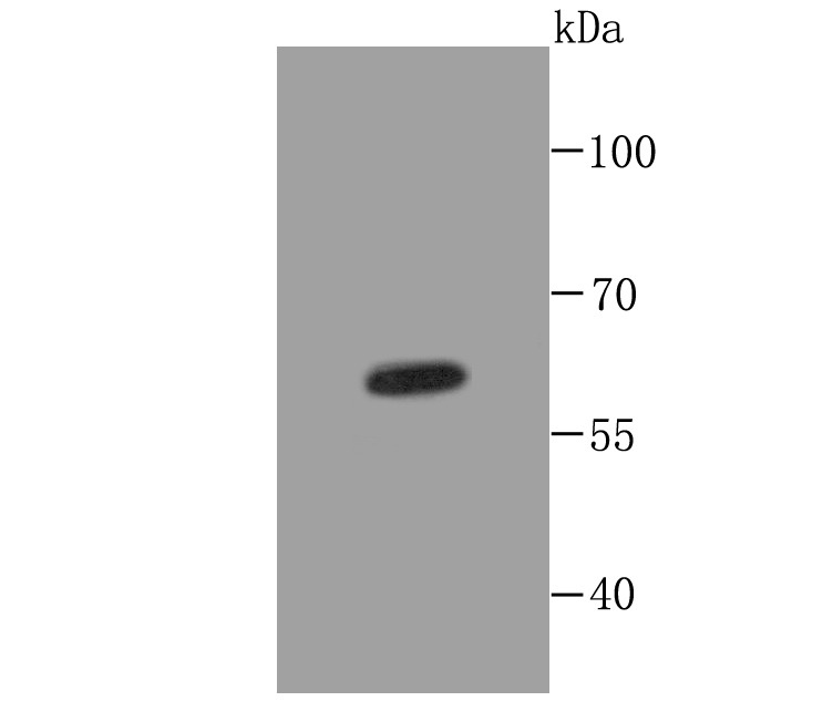 Anti-KRT5 Antibody (1O482)