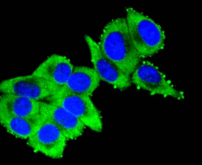 Anti-KRT16 Antibody (3O311)