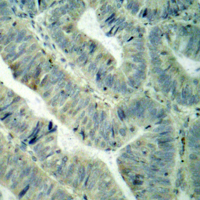 Anti-Phospho-Src/FYN/YES1 (Tyr419/420/426) Polyclonal Antibody