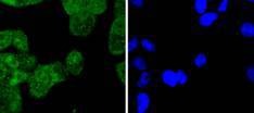 Anti-KRT4 Antibody (5F548)