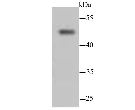 Anti-KRT13 Antibody (2C427)