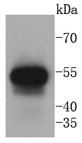 Anti-KRT13 Antibody (2C427)