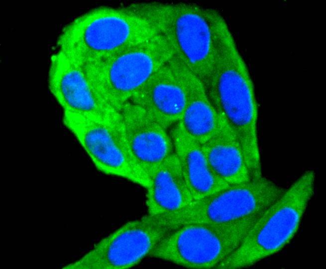 Anti-KRT18 Antibody (5J111)