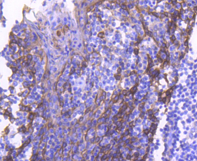 Anti-KRT4 Antibody (8Y508)