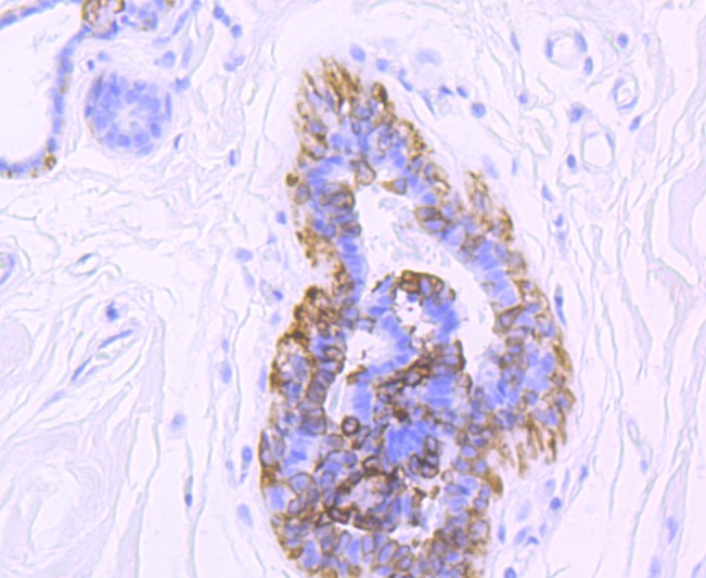 Anti-KRT5 Antibody (1O482)