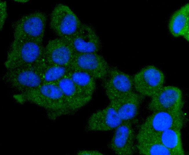 Anti-KRT13 Antibody (2C427)