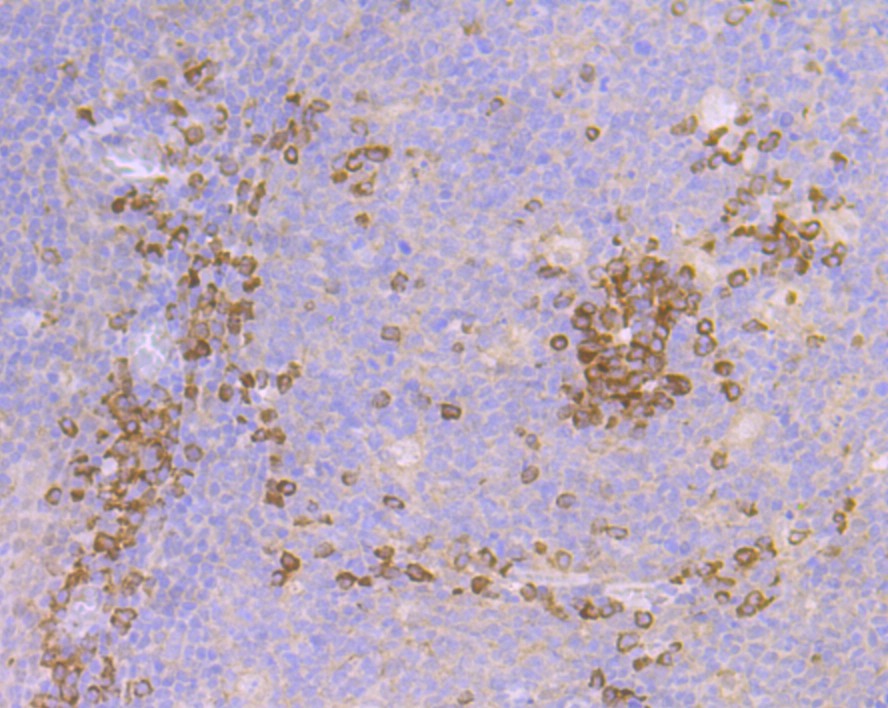 Anti-Cullin 2 Antibody (5U128)