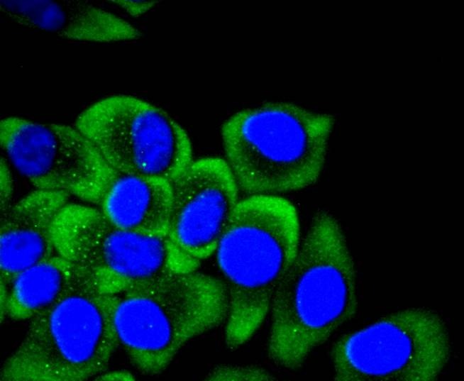 Anti-KRT14 Antibody (3K758)