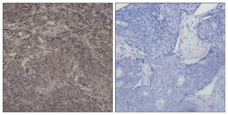 Anti-Phospho-CREB1 (Ser142) Polyclonal Antibody 2