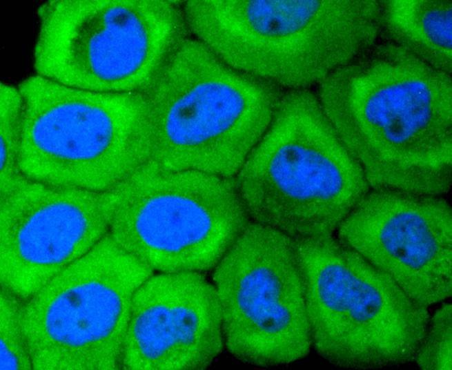 Anti-KRT18 Antibody (5J111)