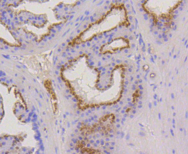 Anti-KRT17 Antibody (9X387)