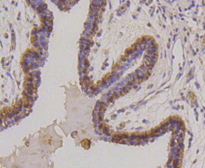 Anti-KRT17 Antibody (9X387)