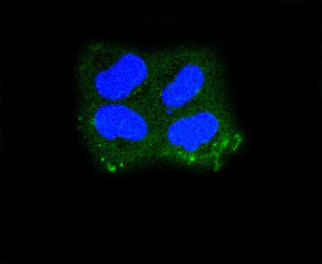 Anti-KRT10 Antibody (5Q202)