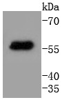 Anti-KRT4 Antibody (8Y508)