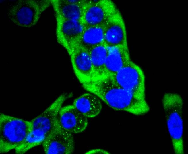 Anti-KRT14 Antibody (3K758)