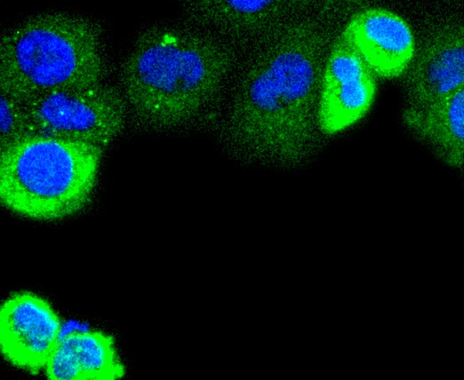 Anti-KRT4 Antibody (8Y508)