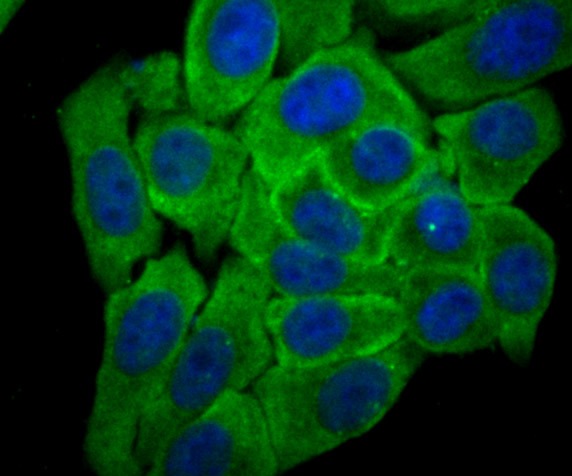 Anti-CYPOR Antibody (2K509)