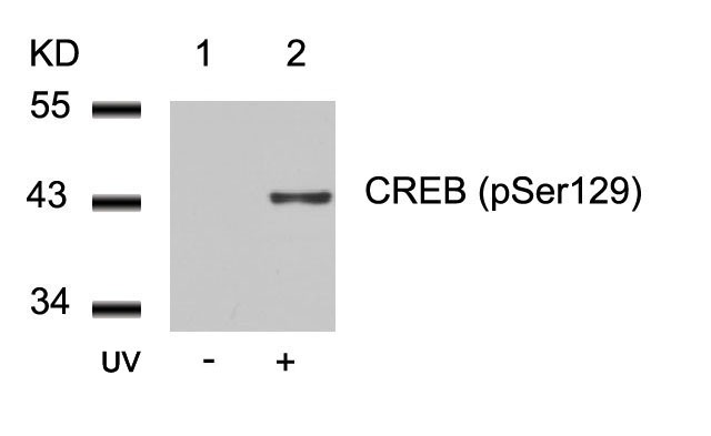 Anti-Phospho-CREB1 (Ser129) Polyclonal Antibody 2
