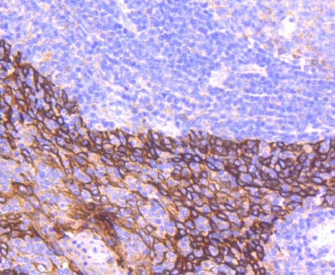 Anti-KRT16 Antibody (3O311)