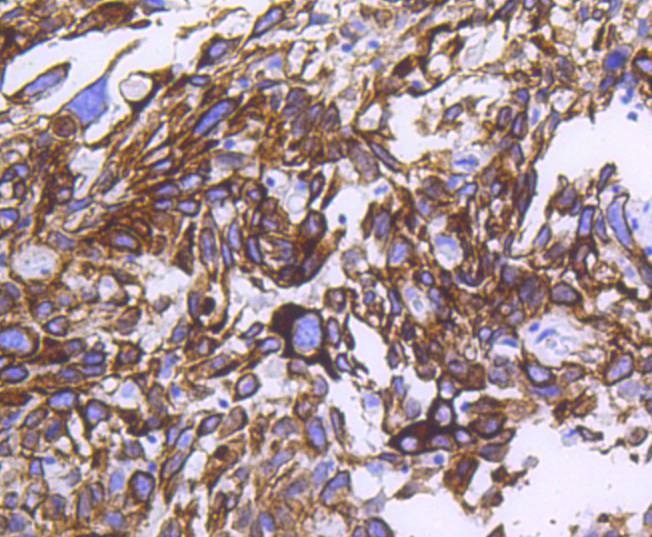 Anti-KRT14 Antibody (3K758)