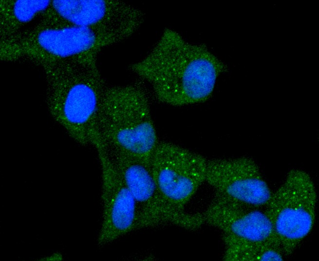 Anti-KRT13 Antibody (2C427)