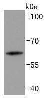 Anti-KRT2 Antibody (6L268)