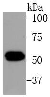 Anti-KRT16 Antibody (3O311)