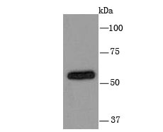 Anti-CYP2D6 Antibody (8H168)